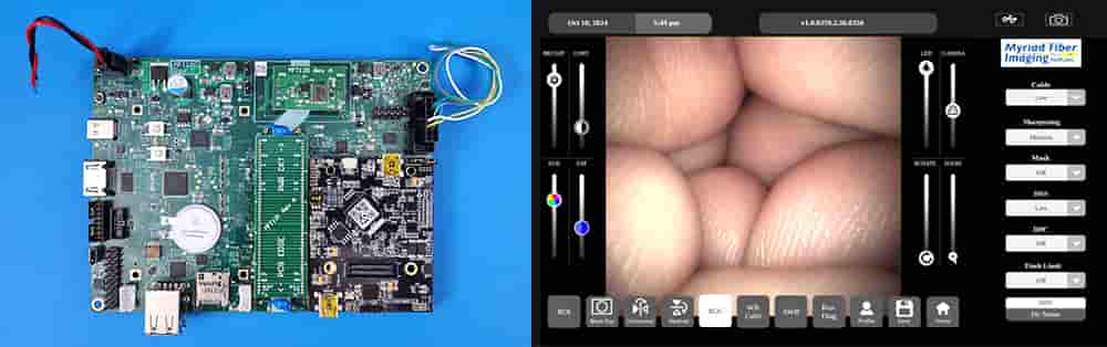 Imaging processing board product picture with imaging output example  from Myriad Fiber Imaging.